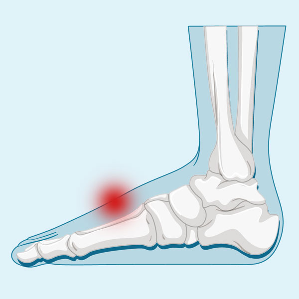 Ejercicios para el dolor de la planta del pie